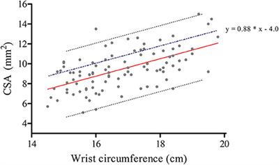 Augmented Diagnostic Accuracy of Ultrasonography for Diagnosing Carpal Tunnel Syndrome Using an Optimised Wrist Circumference-Dependent Cross-Sectional Area Equation